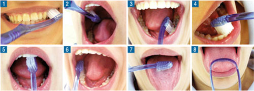 Control Odontológico de Niño Sano